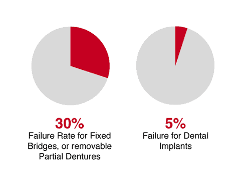 dental implants failure rate Dentistry at Vitality Health Compleo