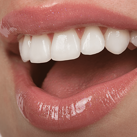white teeth by Dentistry at Vitality Health Compleo