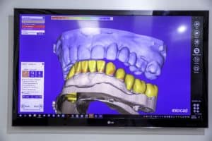 teeth model on operatory machine room by Dentistry at Vitality Health Compleo