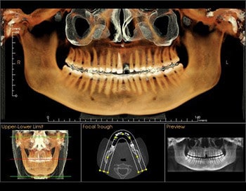 dental x-rays by Dentistry at Vitality Health Compleo