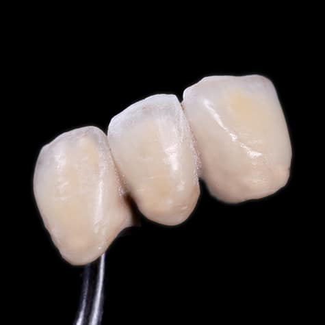 three teeth - Dentistry at Vitality Health Compleo